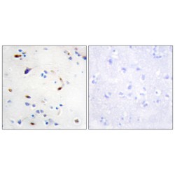 Zinc Finger E-Box-Binding Homeobox 2 (ZEB2) Antibody