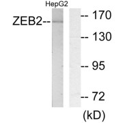 Western blot analysis of extracts from HepG2 cells, using ZEB2 antibody.