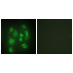 Heterogeneous Nuclear Ribonucleoprotein Q (hnRNP Q) Antibody