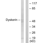 Western blot analysis of extracts from HeLa cells, using Dyskerin antibody.