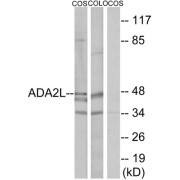 Western blot analysis of extracts from COS-7 cells and COLO205 cells, using ADA2L antibody.