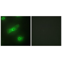 TNF- And APOL-Related Leukocyte Expressed Ligand 2 (TALL-2) Antibody