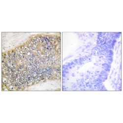 TNF- And APOL-Related Leukocyte Expressed Ligand 2 (TALL-2) Antibody