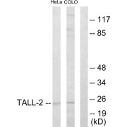 Western blot analysis of extracts from HeLa cells and COLO205 cells, using TALL-2 antibody.