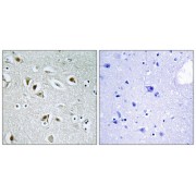 Immunohistochemistry analysis of paraffin-embedded human brain tissue, using CDKA2 antibody.