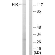 Western blot analysis of extracts from HuvEc cells, using FIR antibody.