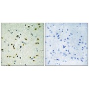 Immunohistochemistry analysis of paraffin-embedded human brain tissue, using JHD3B antibody.