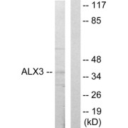 Western blot analysis of extracts from 293 cells, using ALX3 antibody.