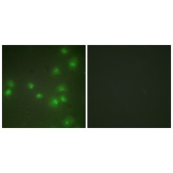 Zinc Finger Protein 265 (ZNF265) Antibody