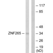 Western blot analysis of extracts from HeLa cells, using ZNF265 antibody.