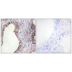 Lecithin Retinol Acyltransferase (LRAT) Antibody