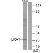 Western blot analysis of extracts from COLO205 cells, using LRAT antibody.