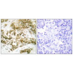 T-Box Transcription Factor TBX15/18 (TBX15/18) Antibody