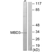 Western blot analysis of extracts from Jurkat cells, using MBD3 antibody.