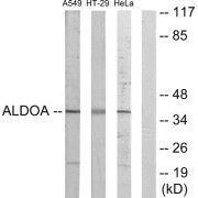 Western blot analysis of extracts from A549 cells, HT-29 cells and HeLa cells, using ALDOA antibody.