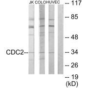 Western blot analysis of extracts from Jurkat cells, COLO205 cells and HUVEC cells, using CDC2 antibody.