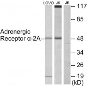 Western blot analysis of extracts from LOVO cells and Jurkat cells, using Adrenergic Receptor alpha 2A antibody.