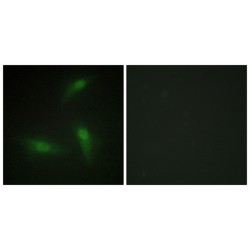 Heterogeneous Nuclear Ribonucleoprotein A1 (hnRNP A1) Antibody