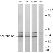 Western blot analysis of extracts from 293 cells, Jurkat cells and COLO205 cells, using hnRNP A1 antibody.