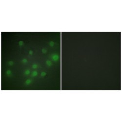 HKR1, GLI-Kruppel Zinc Finger Family Member (HKR1) Antibody