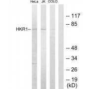 Western blot analysis of extracts from HeLa cells, Jurkat cells and COLO205 cells, using HKR1 antibody.