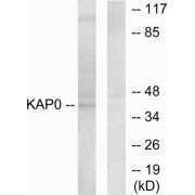 Western blot analysis of extracts from HepG2 cells, using KAP0 antibody.