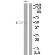 E3 SUMO-Protein Ligase EGR2 (EGR2) Antibody