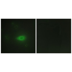 Histidine--tRNA Ligase, Cytoplasmic (HARS) Antibody