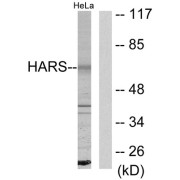 Western blot analysis of extracts from HeLa cells, using HARS antibody.