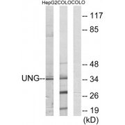 Western blot analysis of extracts from HepG2 cells and COLO cells, using UNG antibody.