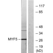 Western blot analysis of extracts from HepG2 cells, using MYF5 antibody. The lane on the right is blocked with the synthesized peptide.