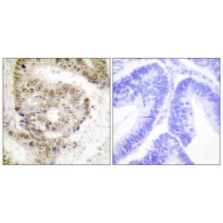 Heterogeneous Nuclear Ribonucleoprotein L (hnRNP L) Antibody