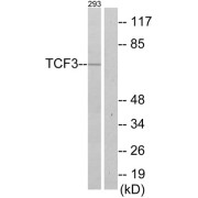 Western blot analysis of extracts from 293 cells, using TCF3 antibody.