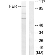 Western blot analysis of extracts from HeLa cells, using FER antibody.