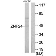 Western blot analysis of extracts from HUVEC cells, using ZNF24 antibody.