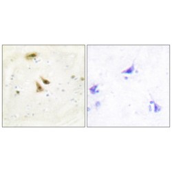 Nucleolar Transcription Factor 1 (UBTF) Antibody