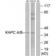 KAPC A / B Antibody