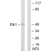 Western blot analysis of extracts from HeLa cells, using Elk1 antibody.