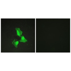 Tumor Necrosis Factor Alpha-Induced Protein 3 (TNAP3) Antibody