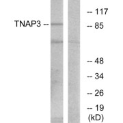 Western blot analysis of extracts from RAW264.7 cells, using TNAP3 antibody.