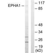 Western blot analysis of extracts from COLO205 cells, using EPHA1 antibody.