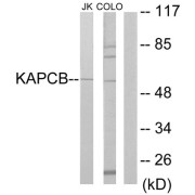 cAMP-Dependent Protein Kinase Catalytic Subunit Beta (KAPCB) Antibody