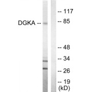Western blot analysis of extracts from Jurkat cells, using DGKA antibody.