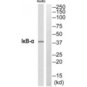 Western blot analysis of extracts from HuvEc cells, using I alpha B- alpha antibody.
