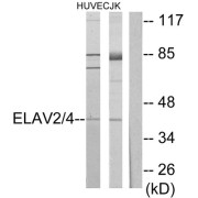 Western blot analysis of extracts from HUVEC cells and Jurkat cells, using ELAV2/4 antibody.