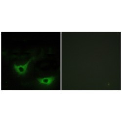 Calreticulin (CALR) Antibody