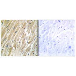 Calreticulin (CALR) Antibody