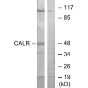 Western blot analysis of extracts from COS-7 cells, using CALR antibody.