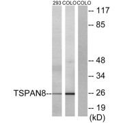 Western blot analysis of extracts from 293 cells and COLO cells, using TSPAN8 antibody.