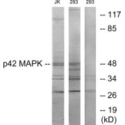 Western blot analysis of extracts from Jurkat cells and 293 cells, using p42 MAPK antibody.